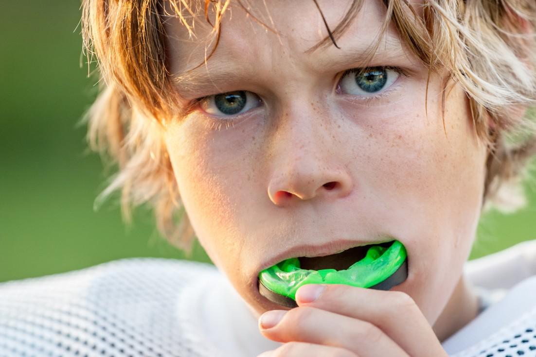 Mouth guards in Timonium, MD