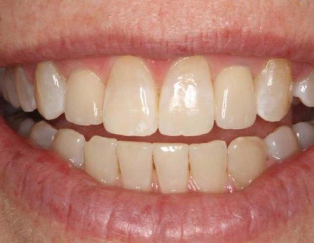 Ortho after