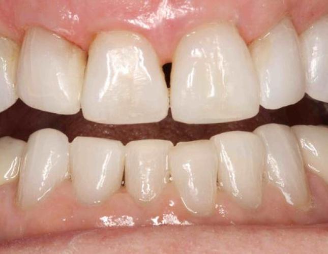 Equilibration after