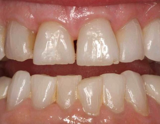 Equilibration before